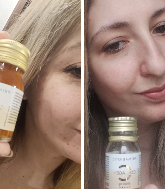 Primabiotic Collagen tyrimo dalyvės odos rezultatas prie&scaron; vartojimą ir po vartojimo