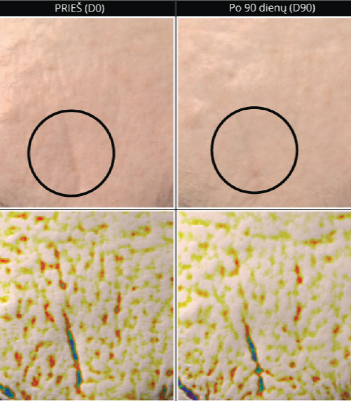 Instrumentinis odos vertinimas prie&scaron; Primabiotic Collagen vartojimą ir po 90 dienų